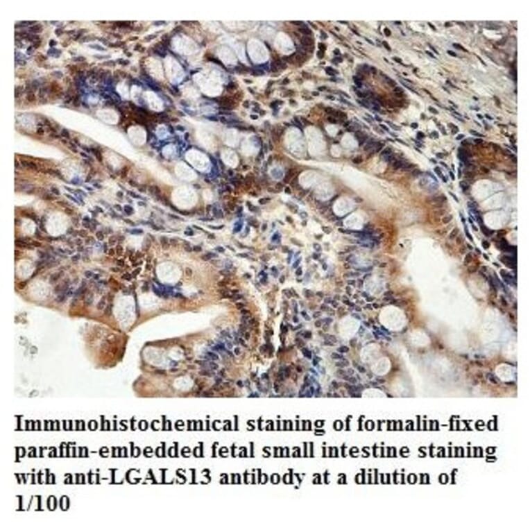 LGALS13 Antibody from Signalway Antibody (39876) - Antibodies.com