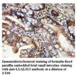 LGALS13 Antibody from Signalway Antibody (39876) - Antibodies.com