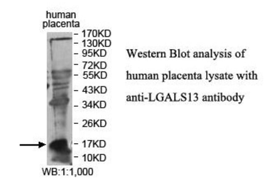 LGALS13 Antibody from Signalway Antibody (39876) - Antibodies.com