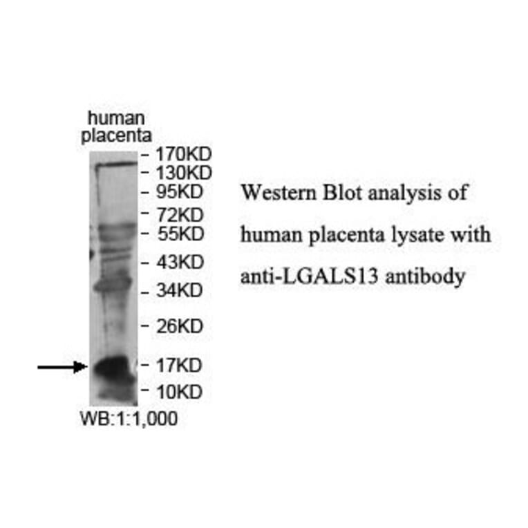 LGALS13 Antibody from Signalway Antibody (39876) - Antibodies.com