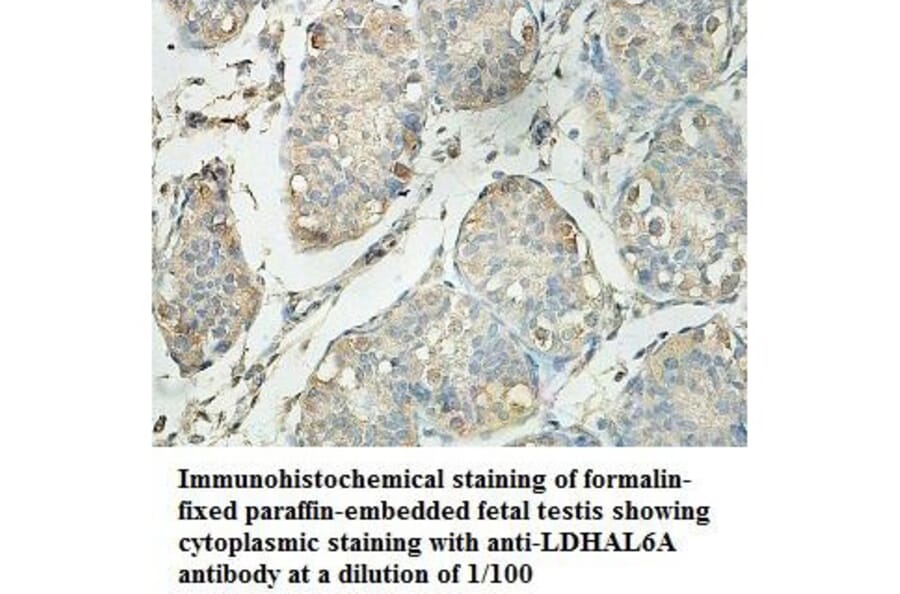 LDHAL6A Antibody from Signalway Antibody (39879) - Antibodies.com