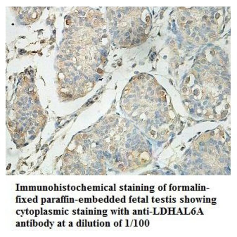 LDHAL6A Antibody from Signalway Antibody (39879) - Antibodies.com
