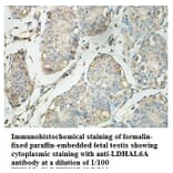 LDHAL6A Antibody from Signalway Antibody (39879) - Antibodies.com