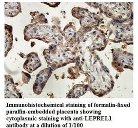 LEPREL1 Antibody from Signalway Antibody (39880) - Antibodies.com