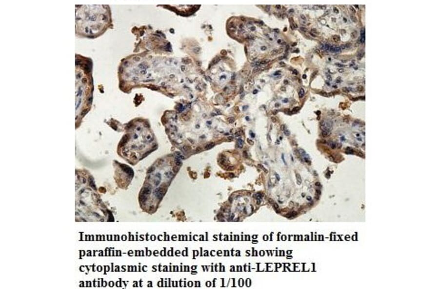 LEPREL1 Antibody from Signalway Antibody (39880) - Antibodies.com