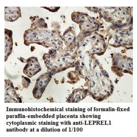 LEPREL1 Antibody from Signalway Antibody (39880) - Antibodies.com