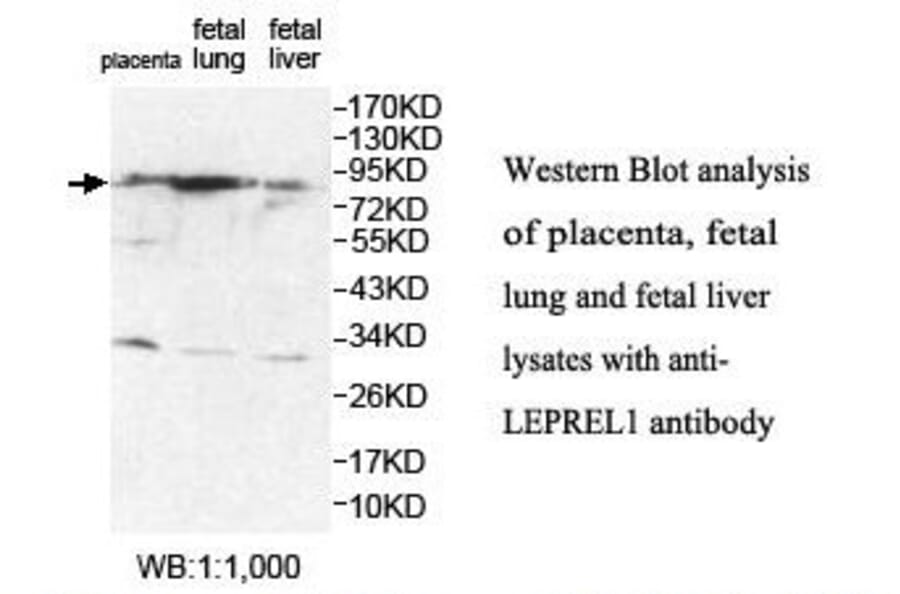 LEPREL1 Antibody from Signalway Antibody (39880) - Antibodies.com