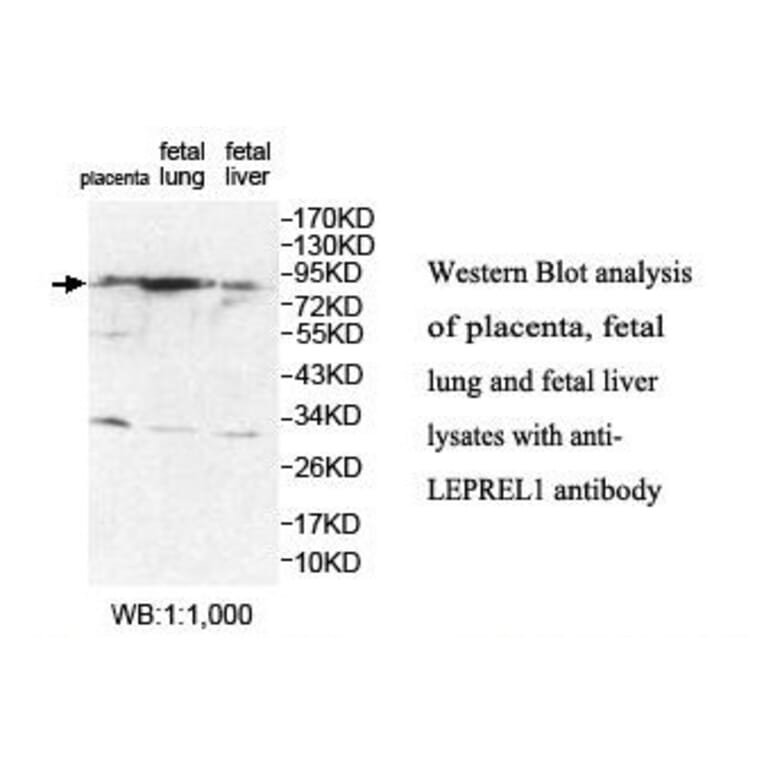 LEPREL1 Antibody from Signalway Antibody (39880) - Antibodies.com