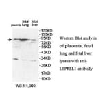 LEPREL1 Antibody from Signalway Antibody (39880) - Antibodies.com