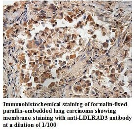 LDLRAD3 Antibody from Signalway Antibody (39887) - Antibodies.com