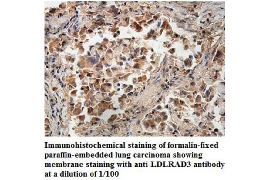 LDLRAD3 Antibody from Signalway Antibody (39887) - Antibodies.com