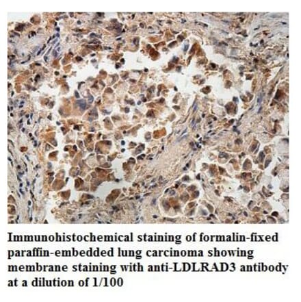 LDLRAD3 Antibody from Signalway Antibody (39887) - Antibodies.com