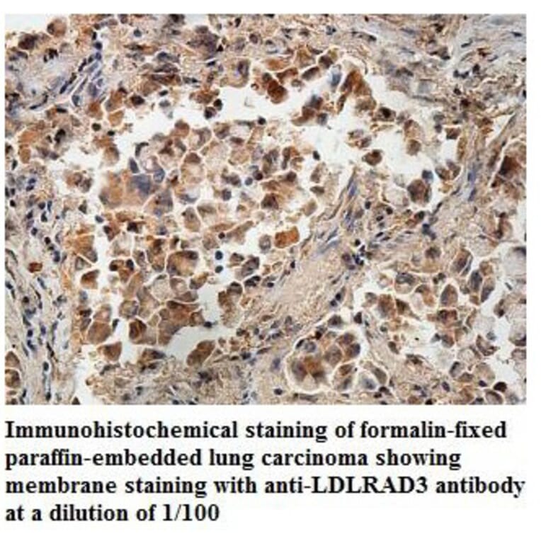 LDLRAD3 Antibody from Signalway Antibody (39887) - Antibodies.com