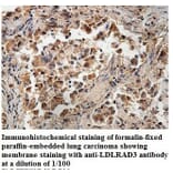 LDLRAD3 Antibody from Signalway Antibody (39887) - Antibodies.com