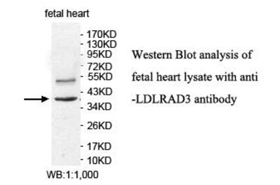 LDLRAD3 Antibody from Signalway Antibody (39887) - Antibodies.com