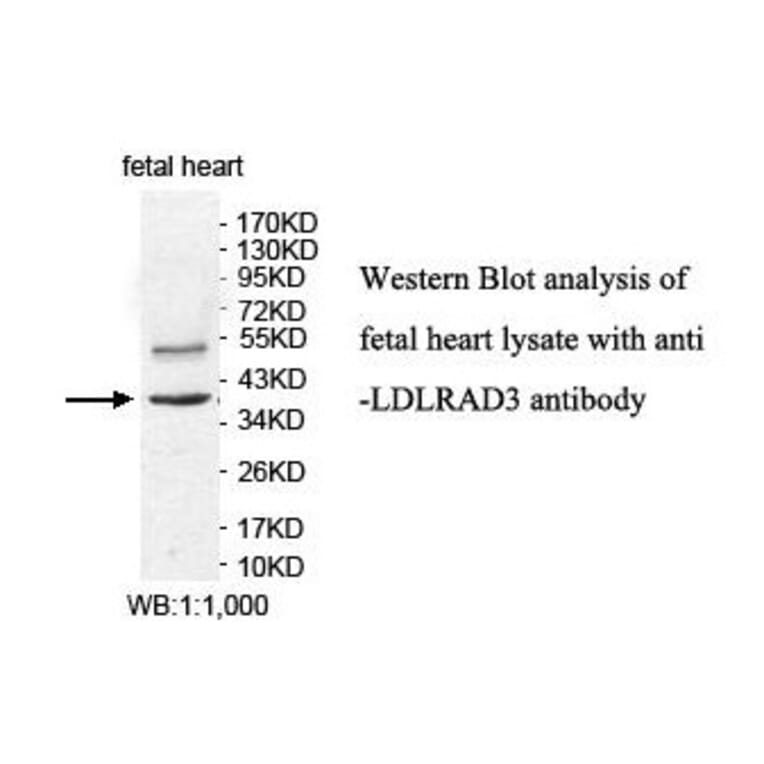 LDLRAD3 Antibody from Signalway Antibody (39887) - Antibodies.com