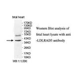 LDLRAD3 Antibody from Signalway Antibody (39887) - Antibodies.com