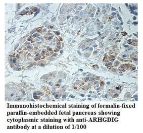 ARHGDIG Antibody from Signalway Antibody (39888) - Antibodies.com