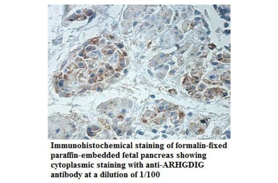 ARHGDIG Antibody from Signalway Antibody (39888) - Antibodies.com