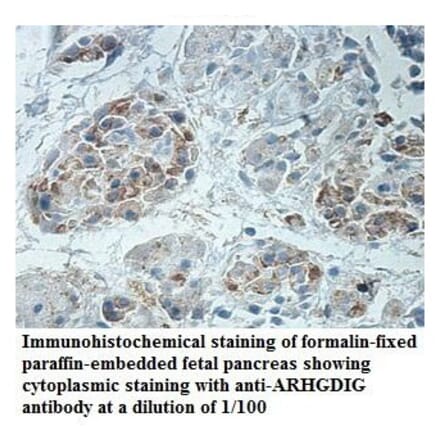 ARHGDIG Antibody from Signalway Antibody (39888) - Antibodies.com