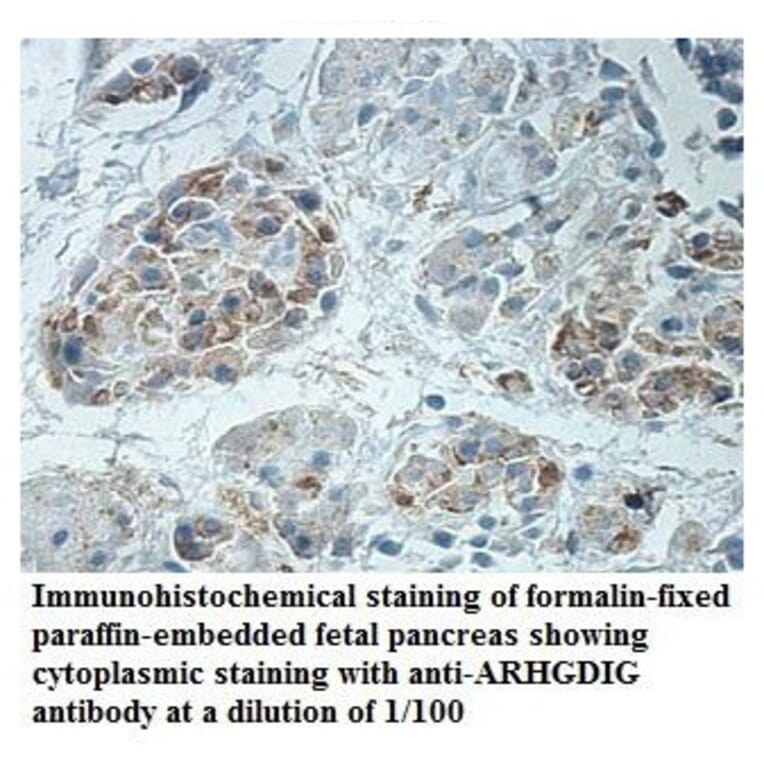 ARHGDIG Antibody from Signalway Antibody (39888) - Antibodies.com