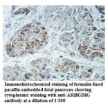 ARHGDIG Antibody from Signalway Antibody (39888) - Antibodies.com