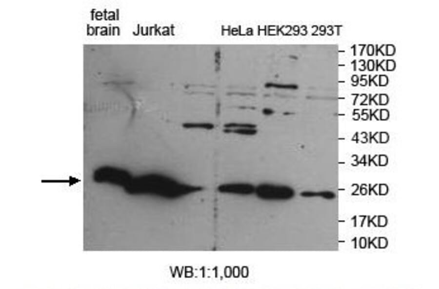 ARHGDIG Antibody from Signalway Antibody (39888) - Antibodies.com