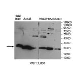 ARHGDIG Antibody from Signalway Antibody (39888) - Antibodies.com