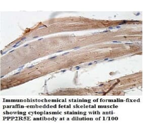 PPP2R5E Antibody from Signalway Antibody (39950) - Antibodies.com