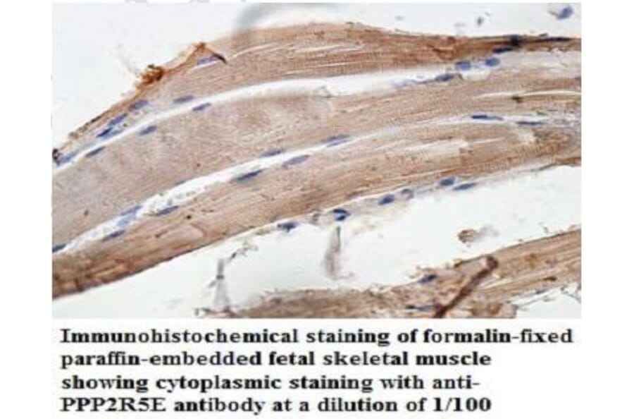 PPP2R5E Antibody from Signalway Antibody (39950) - Antibodies.com
