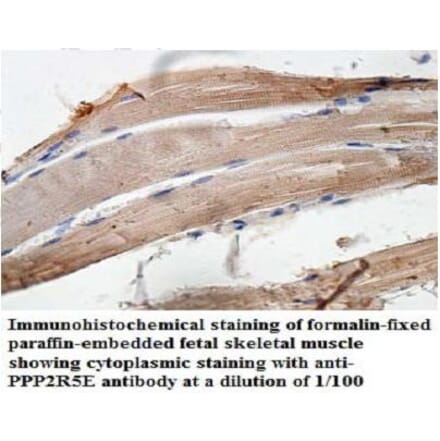 PPP2R5E Antibody from Signalway Antibody (39950) - Antibodies.com