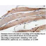 PPP2R5E Antibody from Signalway Antibody (39950) - Antibodies.com