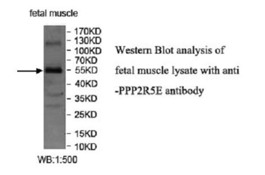 PPP2R5E Antibody from Signalway Antibody (39950) - Antibodies.com