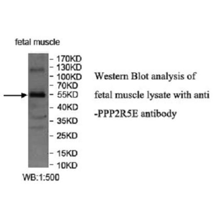 PPP2R5E Antibody from Signalway Antibody (39950) - Antibodies.com