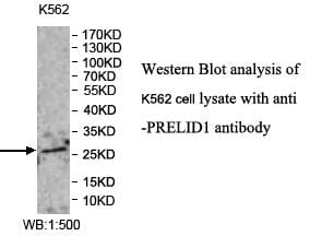 Anti-PRELID1 Antibody