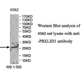 PRELID1 Antibody from Signalway Antibody (39979) - Antibodies.com