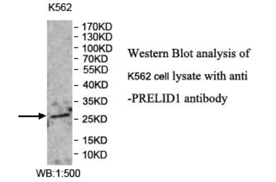 PRELID1 Antibody from Signalway Antibody (39979) - Antibodies.com