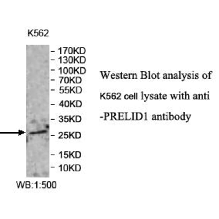 PRELID1 Antibody from Signalway Antibody (39979) - Antibodies.com