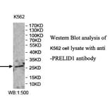 PRELID1 Antibody from Signalway Antibody (39979) - Antibodies.com