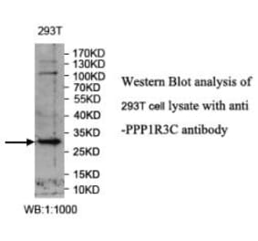 PPP1R3C Antibody from Signalway Antibody (39988) - Antibodies.com