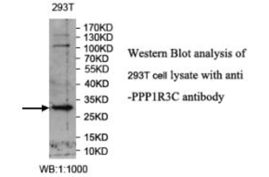 PPP1R3C Antibody from Signalway Antibody (39988) - Antibodies.com