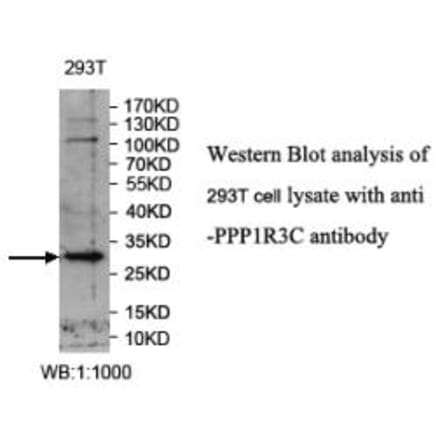 PPP1R3C Antibody from Signalway Antibody (39988) - Antibodies.com