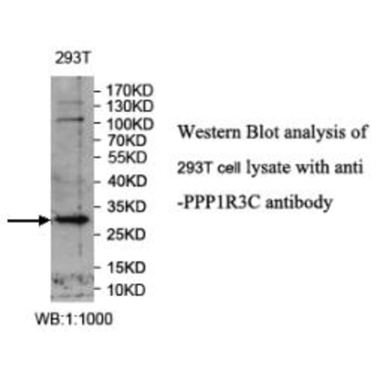 PPP1R3C Antibody from Signalway Antibody (39988) - Antibodies.com