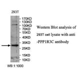 PPP1R3C Antibody from Signalway Antibody (39988) - Antibodies.com