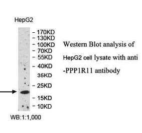 PPP1R11 Antibody from Signalway Antibody (39991) - Antibodies.com