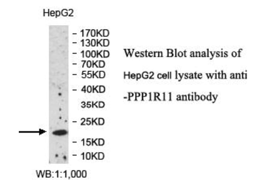 PPP1R11 Antibody from Signalway Antibody (39991) - Antibodies.com