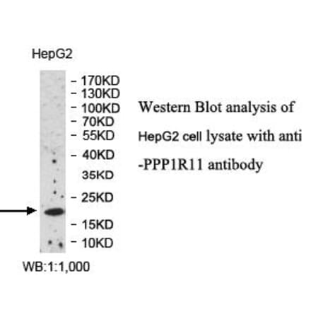 PPP1R11 Antibody from Signalway Antibody (39991) - Antibodies.com