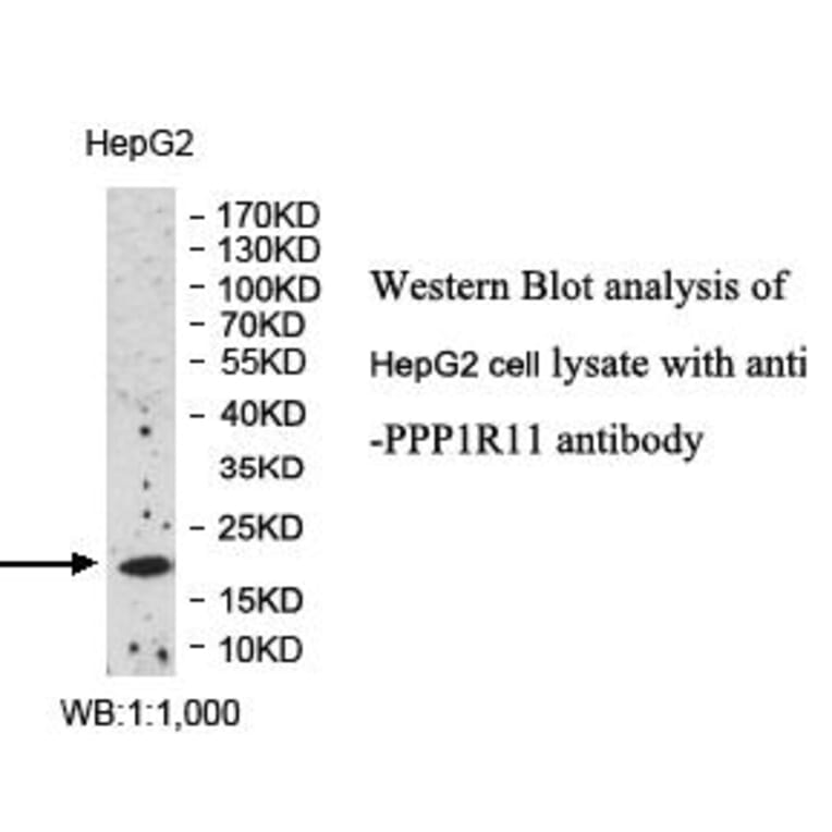 PPP1R11 Antibody from Signalway Antibody (39991) - Antibodies.com