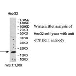 PPP1R11 Antibody from Signalway Antibody (39991) - Antibodies.com