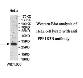 PPP1R3B Antibody from Signalway Antibody (39992) - Antibodies.com